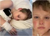 A mum has issued a warning after her 11-year-old son became critically ill from a rare side effect of Covid 