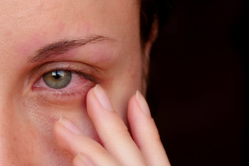 Some people have reported suffering with eye problems after contracting coronavirus. Conjunctivitis can be a symptom, along with sore and itchy eyes, and sensitivity to light.