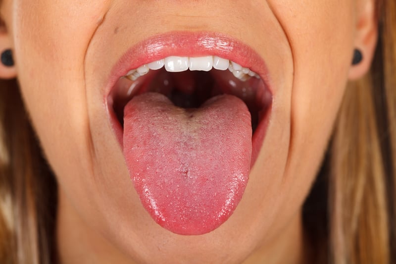 Feeling like you have a burning tongue and mouth during the menopause isn’t uncommon. The under-researched condition – actually called Burning Mouth Syndrome – can cause pain, altered taste and a drop in saliva production.