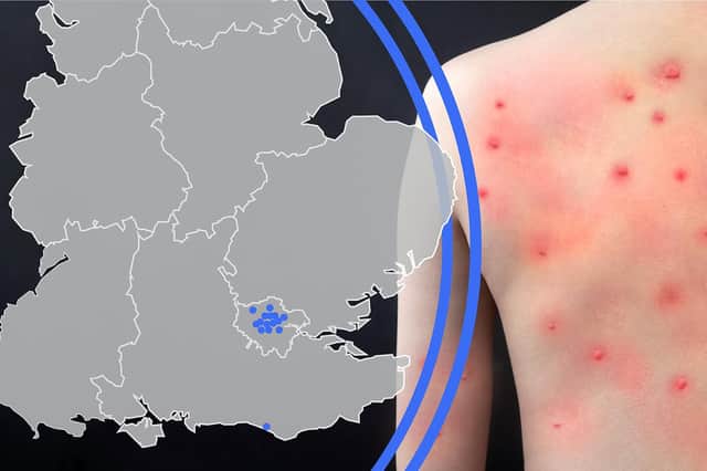 Thousands of monkeypox cases have been identified across England.