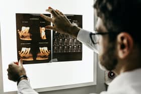 Radiographers are the medical professionals responsible for carrying out X-rays, MRI and CT scans, ultrasounds, breast screenings, as well as radiotherapy for cancer patients.