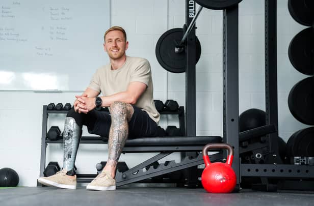 Craig Walton underwent a below-the-knee amputation after traumatic injuries from a road traffic accident. He has since qualified as a personal trainer and is taking on charity work. He received compensation thanks to national law firm Thompson's Solicitors.