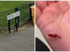 Windmill Lane dog attack Sheffield: Woman wounded trying to help before armed police arrived