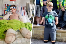 Luke Mortimer in hospital (L) and more recently with the Band of Builders team (R).  A team of big-hearted builders have joined forces to adapt the home of a 10-year-old lad who lost his arms and legs to a rare illness - for free. Picture:BandofBuilders/AdamMortimer/SWNS
