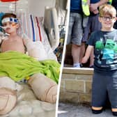 Luke Mortimer in hospital (L) and more recently with the Band of Builders team (R).  A team of big-hearted builders have joined forces to adapt the home of a 10-year-old lad who lost his arms and legs to a rare illness - for free. Picture:BandofBuilders/AdamMortimer/SWNS