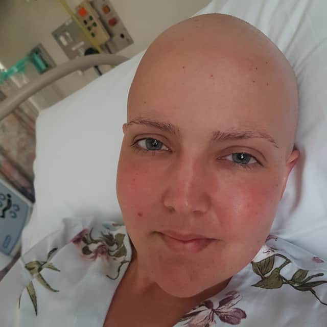 Chemotherapy saw Elena's hair begin to fall out, before she ultimately shaved it off.