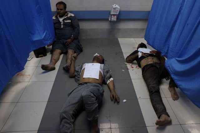 GRAPHIC CONTENT: Injured Palestinians wait for treatment at the overcrowded emergency ward of Al-Shifa hospital in Gaza City following an Israeli airstrike on October 11, 2023. Credit: AFP via Getty Images