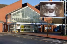 Ellie Taylor found out her miscarried baby's remains had been 'forgotten' in Chesterfield Royal Hospital's mortuary for over 15 months.