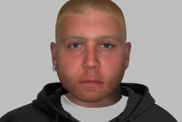 Do you know anyone who has unexplained facial injuries sustained in early January?