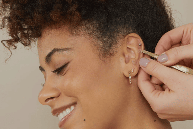 Giselle Boxer set up a business selling ‘ear seeds’ - tiny beads, based on acupuncture principles, which are applied to the ear to stimulate nerve endings.
