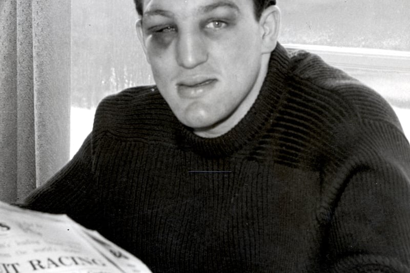 Brian London on January 13th 1959, 24 hours after his fight with Henry Cooper