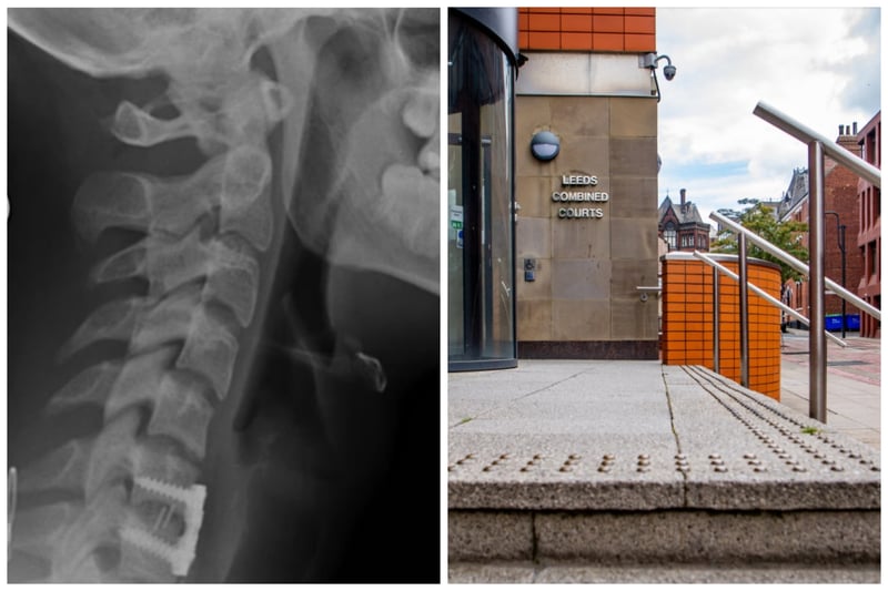 The 21-year-old "utterly ruined" his friend's life after breaking his neck and leaving him partially paralysed during a freak altercation. Garside, of Kirkstall Lane, Kirkstall, attacked the man when he tried to break up a boozy argument between Garside and his girlfriend. 