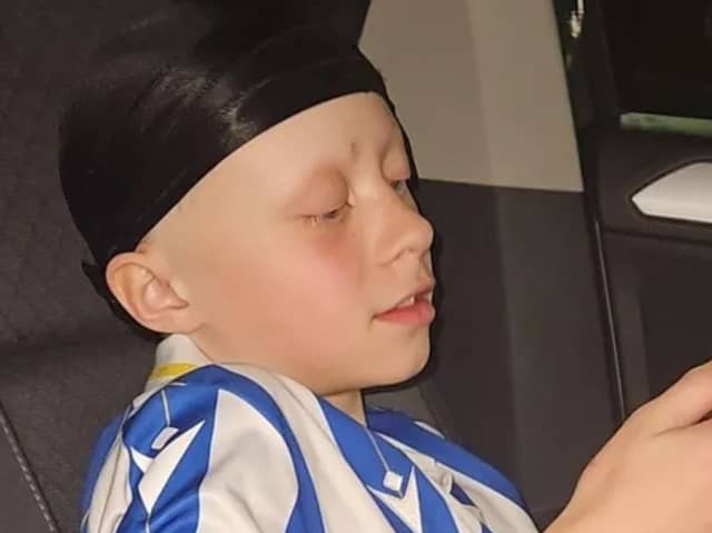 Lekai, who plays for Sheffield Wednesday Under-13s, has lost all his hair after developing the autoimmune condition alopecia universalis. His family are trying to raise the money to pay for a treatment which will restore the youngster's hair.