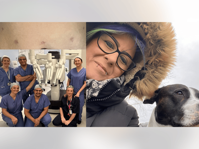 Katie Titman, aged 42, is the first patient in South Yorkshire to benefit from a robot-assisted hysterectomy, in which a surgeon controls a robot from a console nearby.