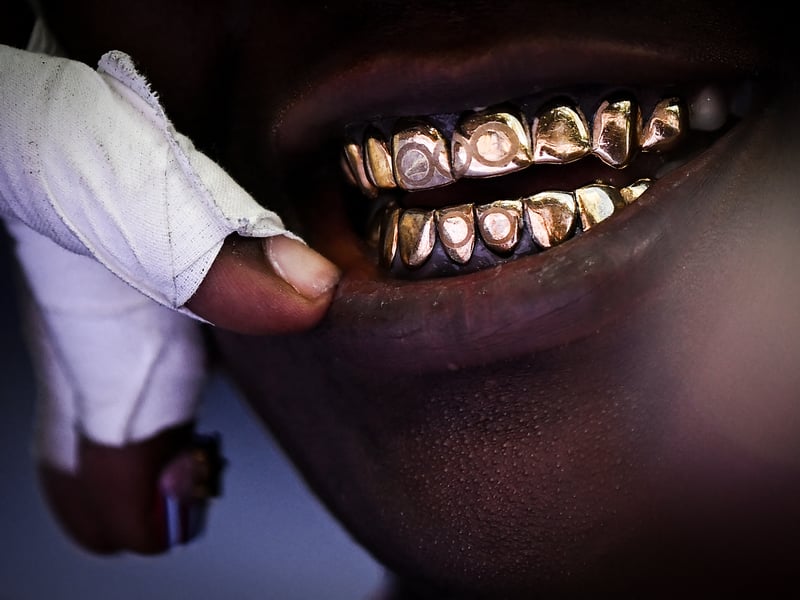 US' Raven Saunders wearing grillz on her teeth reacts as she competes in the women's shot put qualification of the athletics event