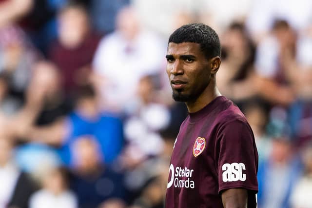 A knee injury has sidelined the Costa Rican full-back until next year.