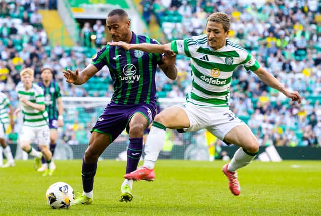 Both Celtic and Hibs have selection decisions to make as the sides clash in the Scottish Premiership at the weekend. Cr: SNS Group.