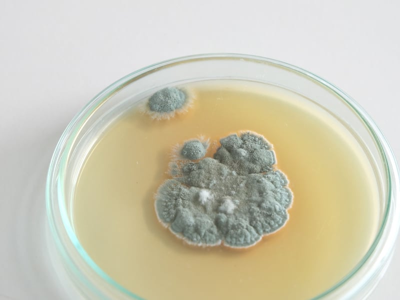 Was penicillin a genuine invention or a discovery? Groundbreaking Scottish scientist Alexander Fleming himself said: "I did not invent penicillin. Nature did that. I only discovered it by accident.” It still came top of our readers' poll though, with Fleming's 1928 observation that mould on an uncovered Petri dish appeared to be killing bacteria going on to save millions of lives.