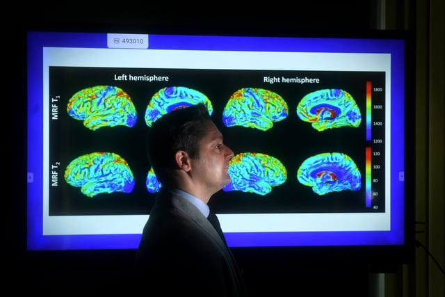 13 inspirational photos as the new Rob Burrow Centre for Motor Neurone ...