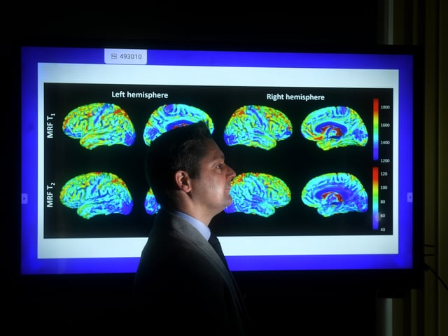 Dr Stuart Currie is pictured with a brain scan on the one of the screens at the centre which opened its doors on Monday in Seacroft. 

