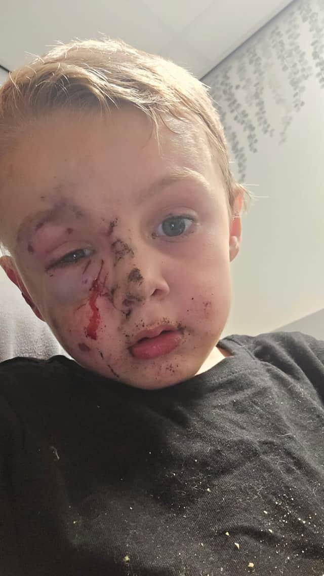 Roman, 5, was mauled by a dog in a Doncaster park