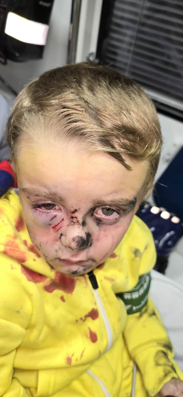 Roman was mauled by a dog in a Doncaster park