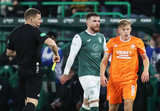 Hibs and Rangers have a number of injury issues ahead of their clash at Easter Road on Sunday. Cr: SNS Group.