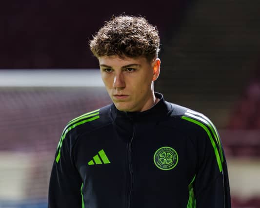 The Belgian midfielder will miss the game with a thigh injury he picked up against Livingston last week.