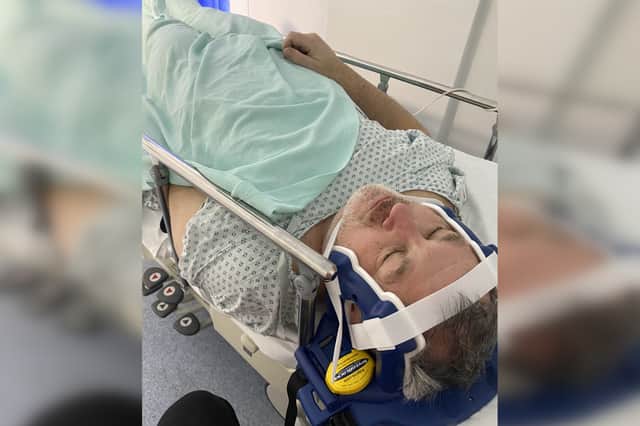 Jason Twibell in the Northern General Hospital after suffering injuries while riding his bike on tram tracks on Middlewood Road, Sheffield. Photo: Gary Twibell