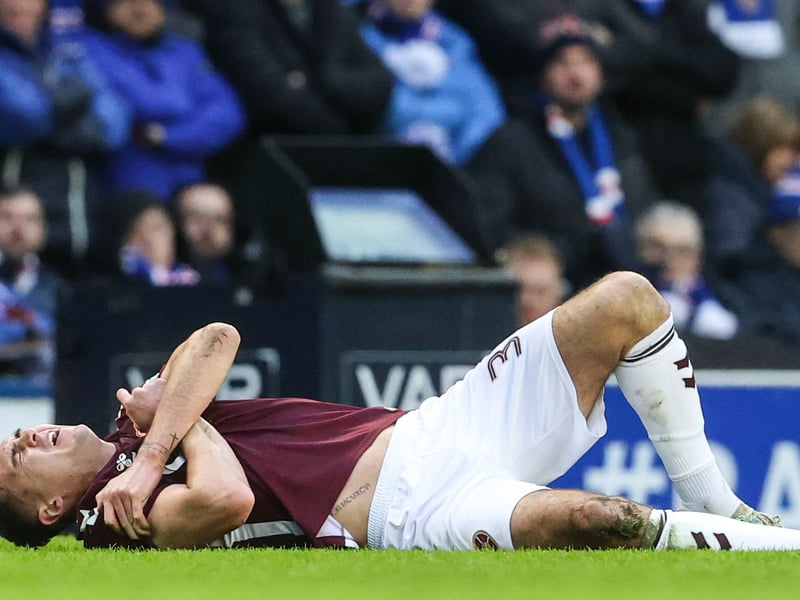 Another doubt for Hearts ahead of this weekend's visit of Aberdeen, the Irishman has an arm injury and is due to see a specialist in Glasgow ahead of the clash.