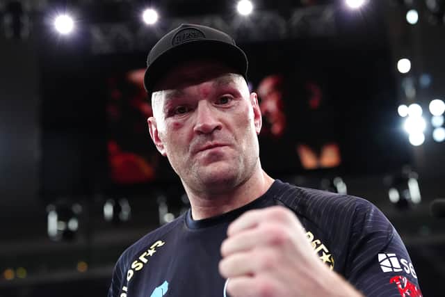 Tyson Fury is confident of beating Anthony Joshua on December 11