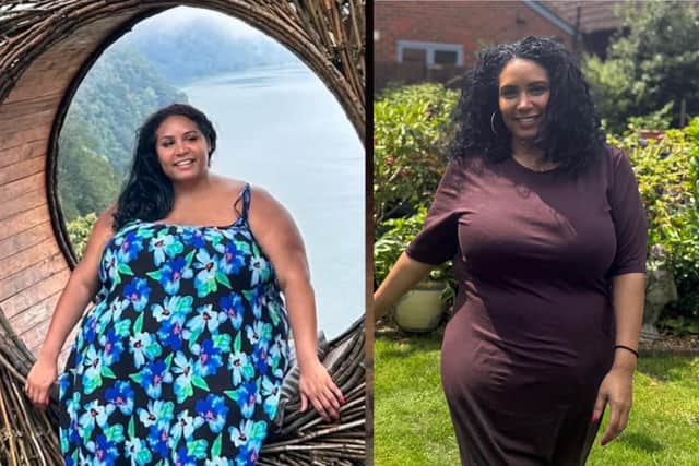 Annalisa before and after losing around 10 stone following gastric sleeve surgery.