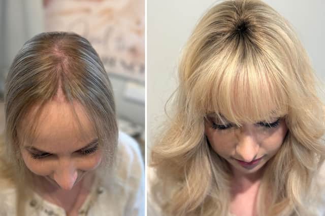 Microline service before and after. 