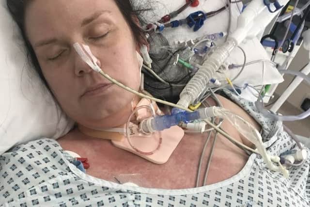 Alex spent six weeks in critical care at the Northern General Hospital