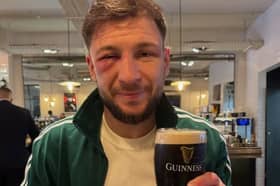Maxi Hughes battered and bruised, but allowing himself a consolation Guinness