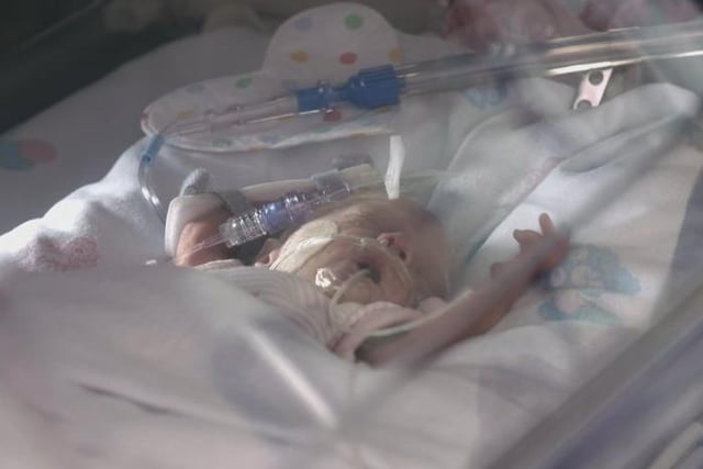 Baby Sofia was born on the edge of viability weighing just 1.5lbs with serious health complications