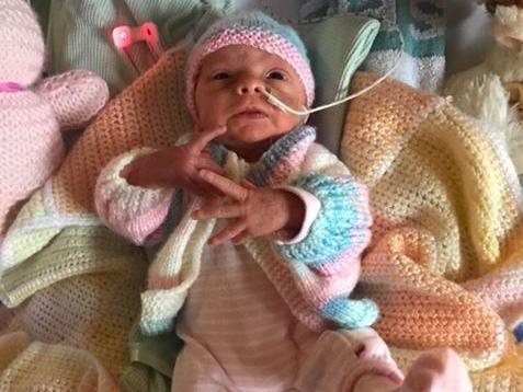 Trinity June Summer Mabberley sent us this photo of Riviera June Louise Pye, who was born by emergency c-section on April 11 at the RLI. She was nine weeks early and weighed 2lb 4oz, and is remaining on the neonatal ward until she gains weight.