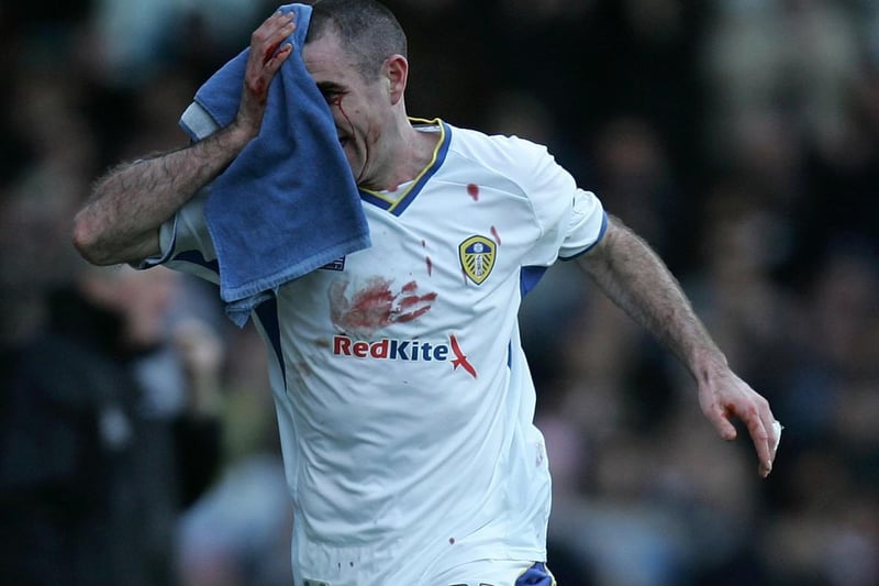 Andy Hughes leaves the field with a head injury during the League One clash against Tranmere Rovers at Elland Road in February 2008.