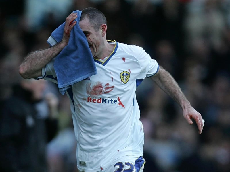 Andy Hughes leaves the field with a head injury during the League One clash against Tranmere Rovers at Elland Road in February 2008.