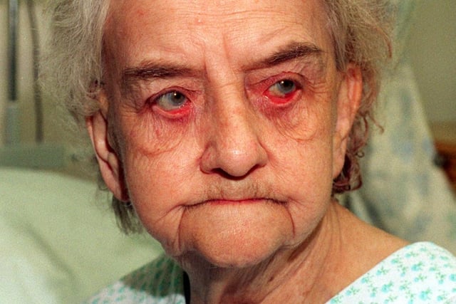 The sad face of 91-year-old Marie Aveyard, who was attacked in the street. She is pictured at Leeds General Infirmary.
