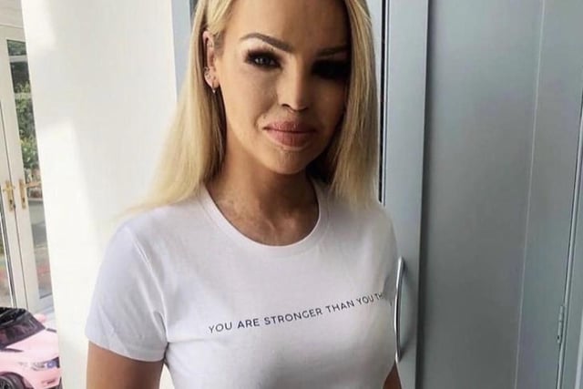 Writer and television presenter Katie Piper SUS-200716-110635001