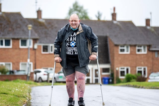 Former bricklayer, Graham Jones, from Harpole was on track to walk 15 laps of the green everyday to pay thanks to the medics who have helped him for the past 20 years.