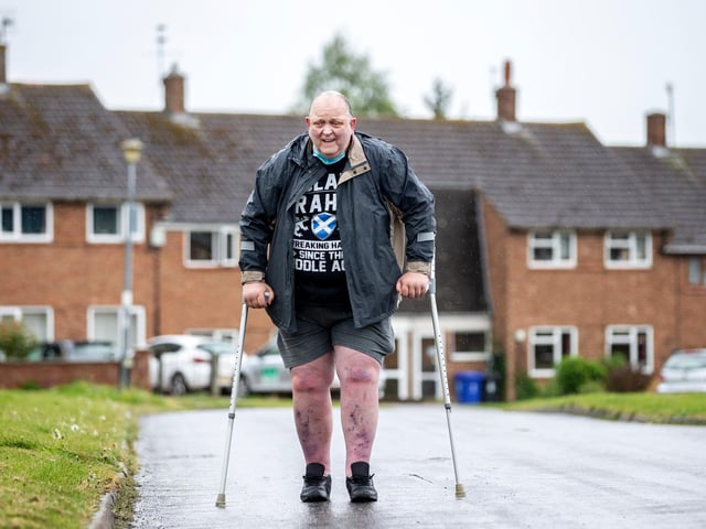 Former bricklayer, Graham Jones, from Harpole was on track to walk 15 laps of the green everyday to pay thanks to the medics who have helped him for the past 20 years.
