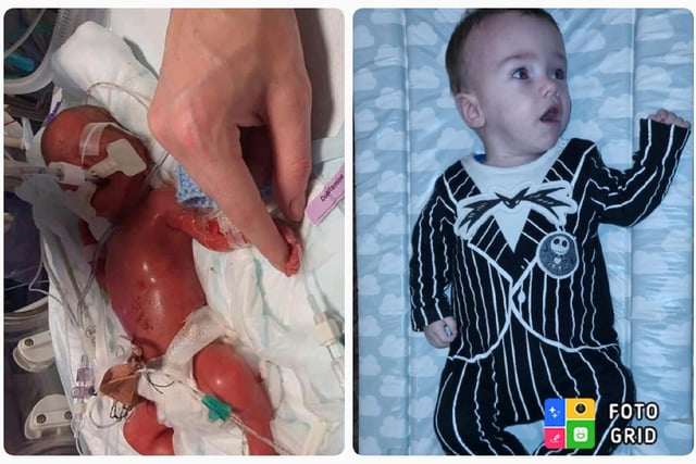 Natalie Marie sent in this heart-warming photo of her little boy, who was born at 25 weeks and is now enjoying his first Halloween dressed as Jack Skellington.