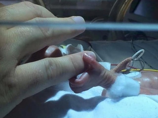 "Theo was born at 27 weeks after I was diagnosed with stage two cervical cancer. We both had a fight on our hands but we fought it together. At his smallest, he was less than one kilogram." - Kelly Abraham