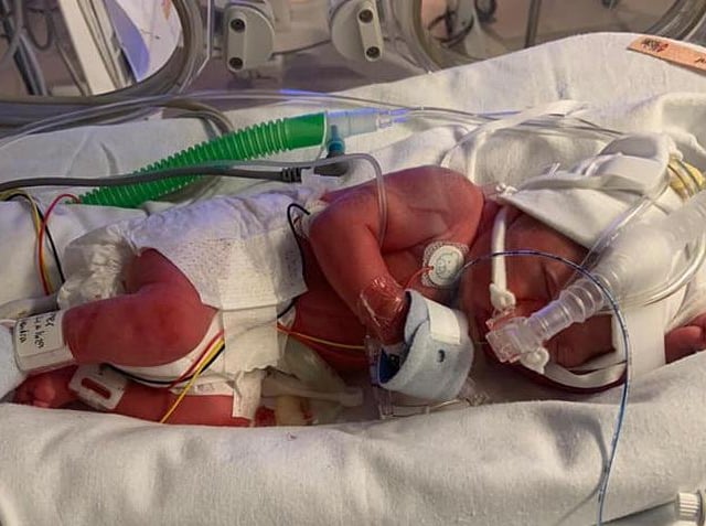 "Maisie was born 10 weeks early. Three pounds and two ounces. She spent five weeks in the NICU. She is now 19 weeks and is amazing." - Alexandra Palmer