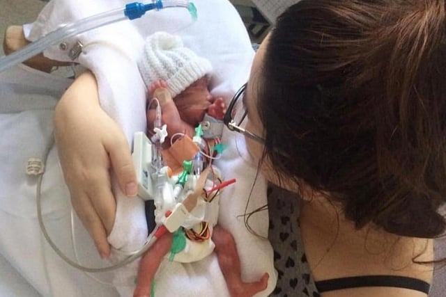 "My little girl was born at 26 weeks weighing two pounds and six ounces, now almost five." - Joanna Fraser