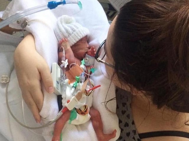 "My little girl was born at 26 weeks weighing two pounds and six ounces, now almost five." - Joanna Fraser