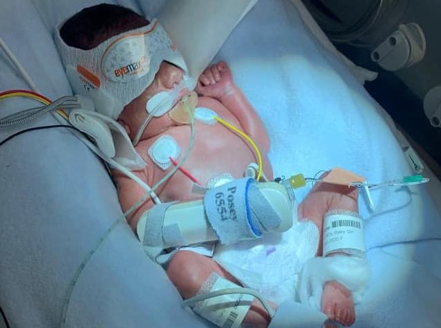 "My baby, Amaya, was born at 29 weeks exactly weighing two pounds and 13 ounces. She’s 22 months now and is such a happy, cheeky, loving little girl. She spent seven and a half weeks in NICU. We’re very fortunate as she had a smooth journey and has had no ongoing health issues. We couldn’t thank the staff at NGH any more for the care we all received during her time there." - Charn Madden