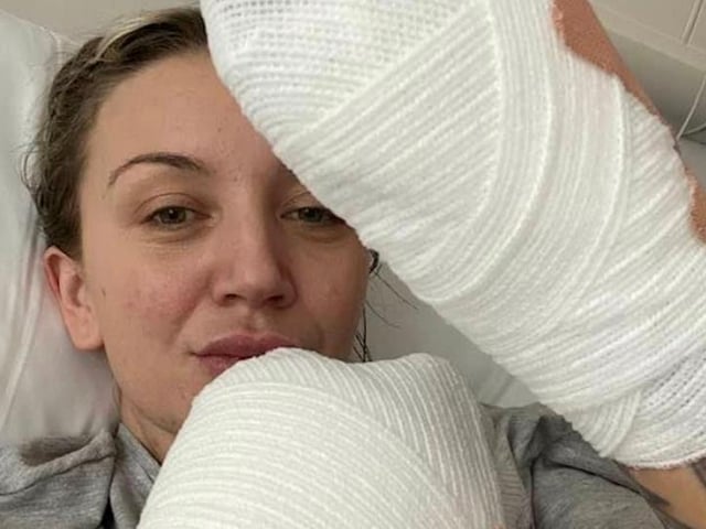 Sadie suffered life changing injuries after surviving sepsis. She has had the fingers on one of her hands amputated and been told that she will need to have her other hand and both legs amputated below her knees.